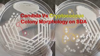 Candida and Cryptococcus Colony Morphology on Sabouraud dextrose agar SDA Demonstration [upl. by Lenrow]