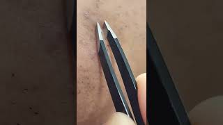 Plucking Extremely Stubborn Facial Hairs With Tweezers [upl. by Bomke240]