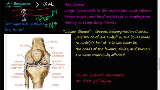 62P  Air Embolism decompression sickness the bends the chokes cassion disease [upl. by Meave]