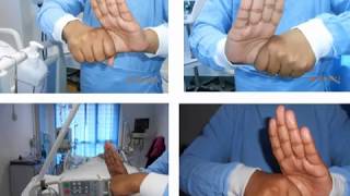 Hospital Infection Control Practices Hindi [upl. by Ssepmet]