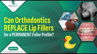 Can Orthodontic Treatment Make you Have Fuller Lips [upl. by Spanos]