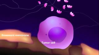 Introduction to Cancer Biology Part 3 Tissue Invasion and Metastasis [upl. by Ycniuqed]