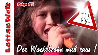 Der Wackelzahn muß raus [upl. by Lenard]