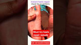 Must try this heels repair hackyoutubeshorts heels repair remedy bollywood [upl. by Harding]