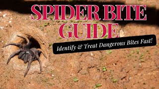 Spider Bite Guide Identify amp Treat Dangerous Bites Fast [upl. by Jessalin73]