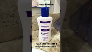 Tratamento de caspa e dermatite seborreica [upl. by Larrabee361]