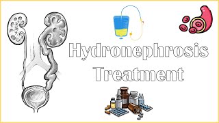 Hydronephrosis Treatment  Medical amp Surgical Management Of Hydronephrosis [upl. by Bruns]