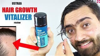 USTRAA HAIR GROWTH VITALIZER REVIEW  HOW TO USE BENEFITS RESULTS  QUALITYMANTRA [upl. by Nanreit109]