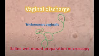 Trophozoites of Trichomonas in saline wet mount [upl. by Publea]