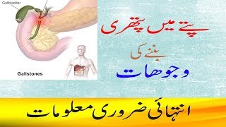 Gallstone Symptoms And Causes in UrduHindipitte ki pathri ki wajohat [upl. by Sirhc684]