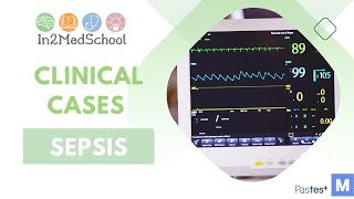 Sepsis Clinical Case [upl. by Donalt]