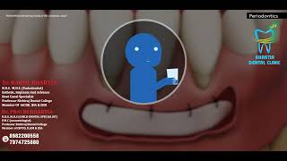 GINGIVAL GRAFT PROCEDURE  PERIODONTICS [upl. by Yelich778]