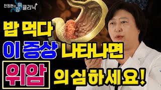 위암 경고 증상 ‘이것’ 놓치면 위암 위험합니다  전정현의 위장 클리닉 8ㅣ위암 전조증상 경고증상 헬리코박터 위암 수술법 위암 예방 [upl. by Earley]