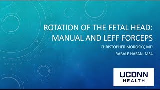 Rotation of the Fetal Head Manual and Leff Forceps [upl. by Enineg383]