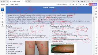 pathology 1  Rheumatic fever CVS [upl. by Alberta]