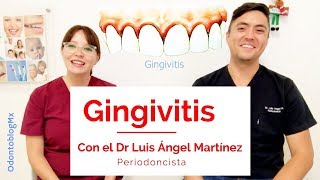 Gingivitis 🩸 con Dr Luis Ángel Martínez [upl. by Adamek]