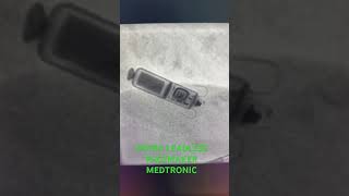 MEDTRONIC MICRA LEADLESS PACEMAKER shorts [upl. by Littlejohn65]