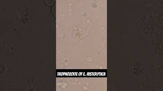 Trophozoite of Entamoeba histolytica [upl. by Ellak]