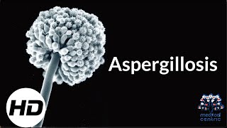 Aspergillosis Everything You Need To Know [upl. by Esihcoc]