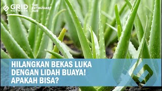 Lidah Buaya Bisa Menghilangkan Bekas Luka Gini Cara Pakai Bahan Alami [upl. by Noemi]