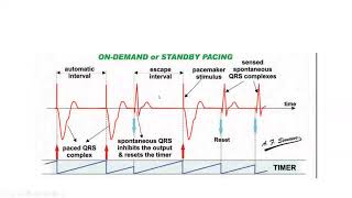 Pacemaker timing cycles and special features  Dr Mohamed Bayoumi [upl. by Templeton]