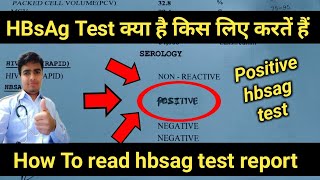 Hbsag Positive  hbsag test  hbsag test in hindi  hbsag test report  hepatitis b test results [upl. by Ruff679]