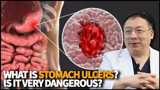 What is Stomach Ulcer What causes it and how dangerous is it when left untreated [upl. by Rosalyn85]