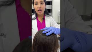 ¿Sabías que existen varios tipos de alopecia [upl. by Hyozo701]