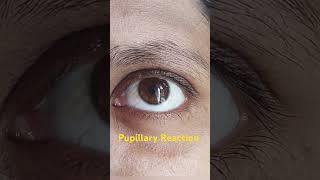 Pupillary reaction in eye [upl. by Yug]