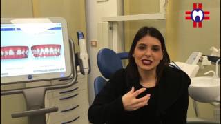 Apparecchio trasparente Invisalign  testimonianza della nostra paziente Krizia [upl. by Anele]