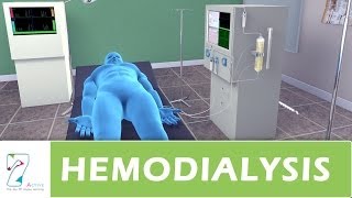 Hemodialysis [upl. by Olracnaig]