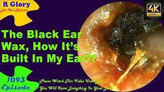 The Black Ear Wax🤦‍♀️How Was Its Built In My Ear🤷‍♂️New Video Ear Wax Removal 1093 ear health [upl. by Peppy]