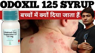 odoxil 125 mg syrup  odoxil 125 mg  odoxil 125  odoxil 125 syrup kis kaam aati hai  odoxil syrup [upl. by Kym]