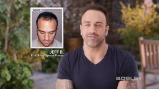 Bosley Hair Transplant Patient Review  Jeff B [upl. by Genie]