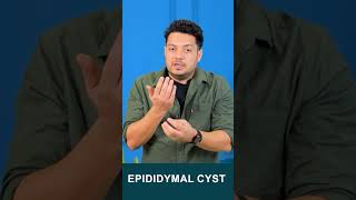 Epididymal Cyst drhealth maleinfertility spermcount himanshudhawan shorts viralshorts [upl. by Jeffy]