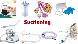 How to do Suctioning procedure l كيفية القيام بعملية الشفط [upl. by Casilda76]