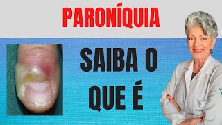 Paroníquia Saiba o Que é E Como Tratar [upl. by Idac799]