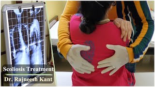 Scoliosis Treatment  Non Surgical Management Of Scoliosis  Dr Rajneesh Kant [upl. by Htebsil]