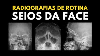 Rotina de seios da face ESTRUTURAS VISUALIZADAS [upl. by Kcod]