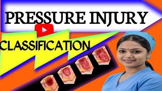 Pressure injury  classification [upl. by Akimit]