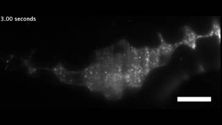 Example of the motile and planktonic behavior of Vibrio in the zebrafish gut [upl. by Sille]