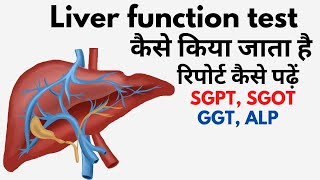 Liver function test in Hindi  lft blood test result in Hindi  lft normal range [upl. by Cheri]