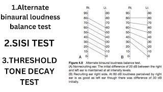 Recruitment Phenomenon  SISI Test  Threshold Tone Decay Test  Special Tests Of Hearing [upl. by Small]