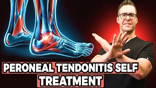 Peroneal Tendonitis Self Treatment Stretches Exercises amp Massage [upl. by Arayk]