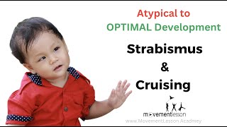 Atypical Development Baby Strabismus And Cruising  for Worried Parents [upl. by Gladis]