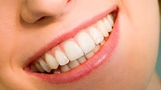 Quais São As Melhores Próteses Dentárias de 2018 Grampos Metálicos Acrílicos Flexível Silicone [upl. by Dominy606]