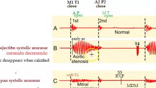 Apex beat part 2  Heaving apex beat  Tapping apex beat [upl. by Tlok521]