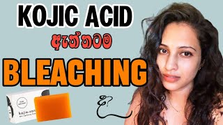 Kojie Soap එක ඇත්තටම bleaching ද [upl. by Rialb667]