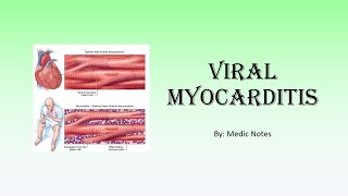 Viral myocarditis  causes Lake Louise criteria clinical features investigations treatment [upl. by Jaylene]