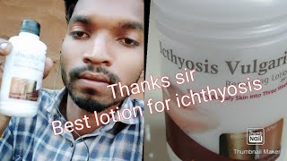 Icthyosis vulgaris removing lotion bhupendra gamit Gujarat [upl. by Trygve758]